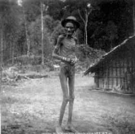 Ondervoede Papoea bij de Angi-meren,c@rol,map,091009,25.jpg